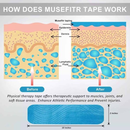 Tape Kinesiológico Precortado Azul 5 cm x 5mt - Imagen 6